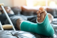Symptoms of a Broken Ankle