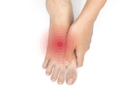Diabetes and Severe Foot Problems